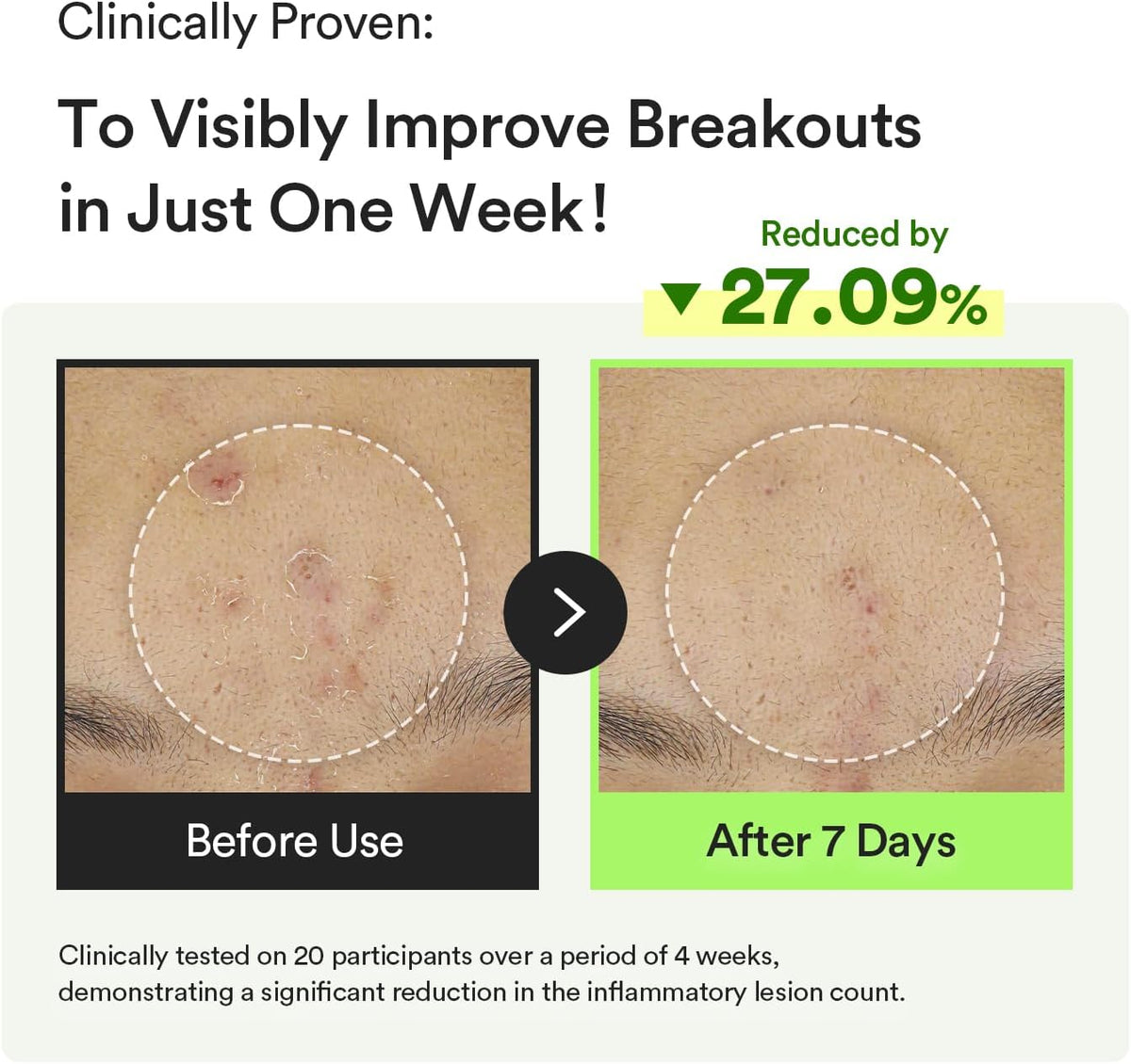 ABIB HEARTLEAF TECA CAPSULE SERUM CALMING DROP