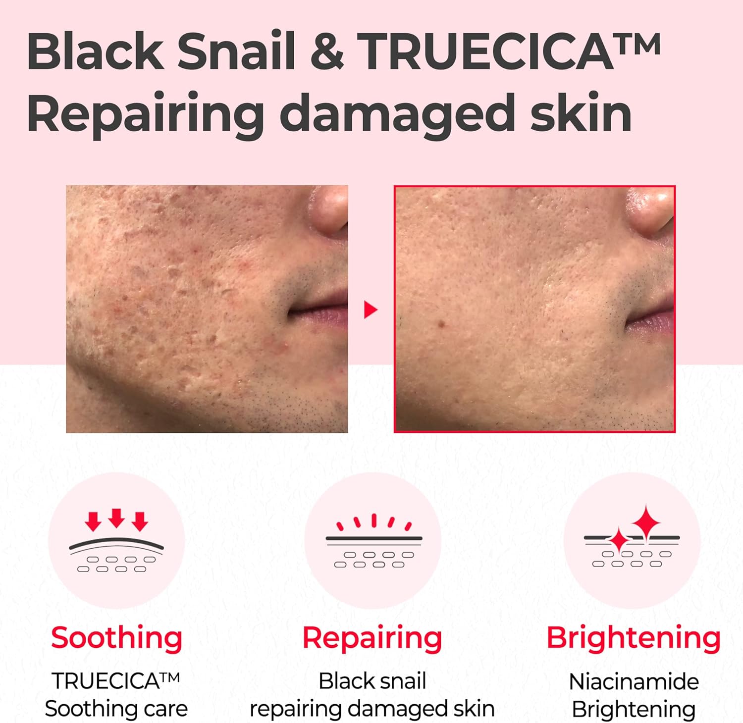 Some By Mi Snail Truecica Miracle Repair Toner 135ML