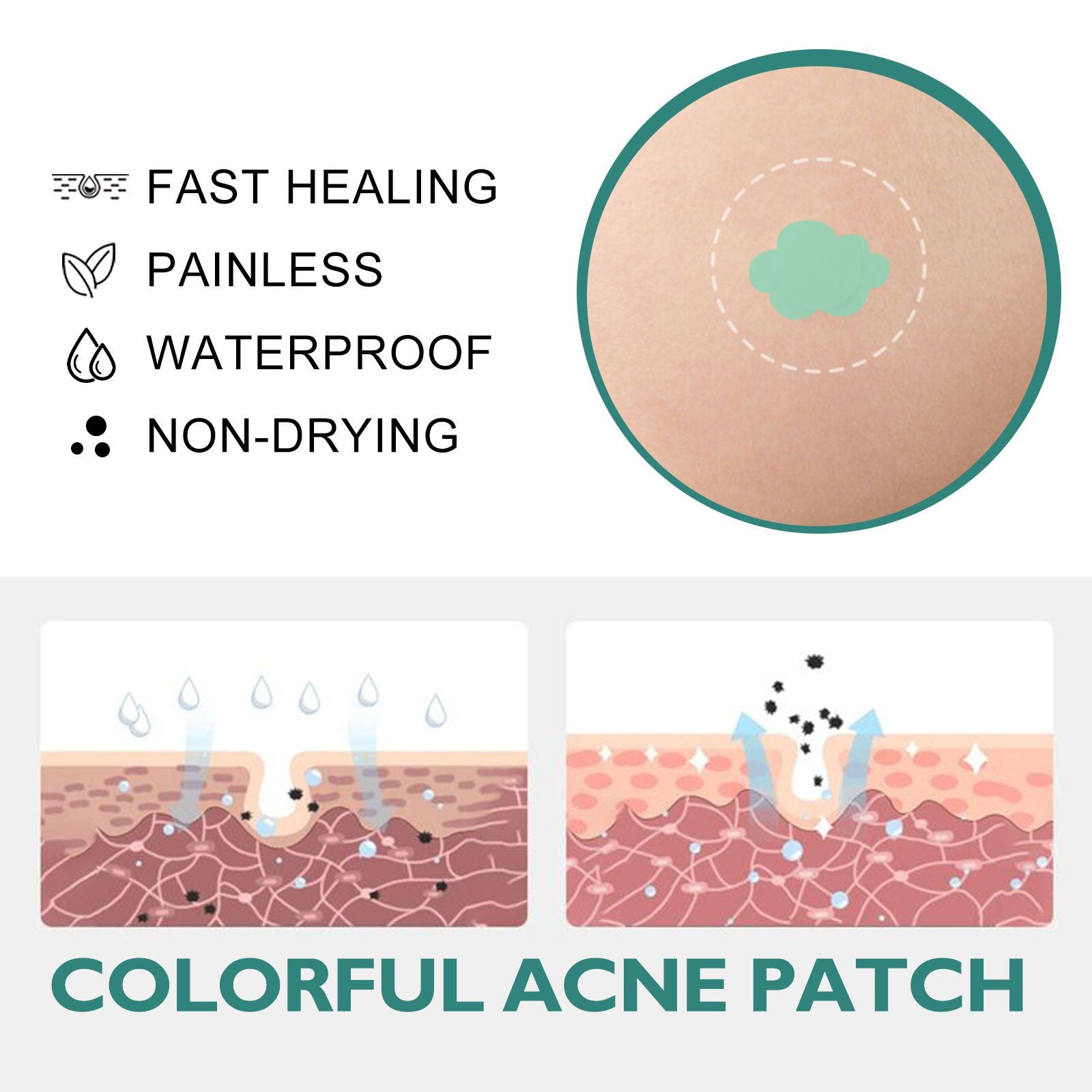 Cartoon Acne Pimple Patches Hydrocolloid Spot Stickers 112pcs