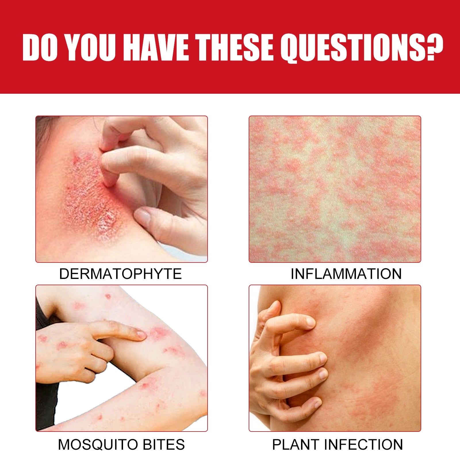 Ultra Soothing Cream, Relieve Skin Redness and Itchiness, Fast Relief for Mosquito Bites, Rash, and Skin Irritation ,60g
