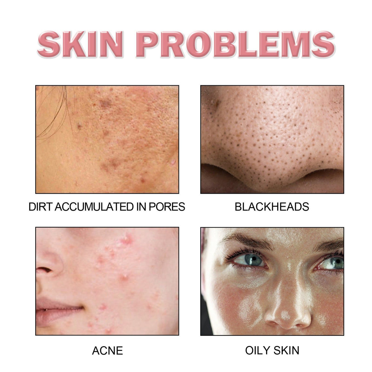 5 in 1 Cleansing Mousse, Deeply Moisturizing, Oil Control, Brightening Acne Marks ,60ml