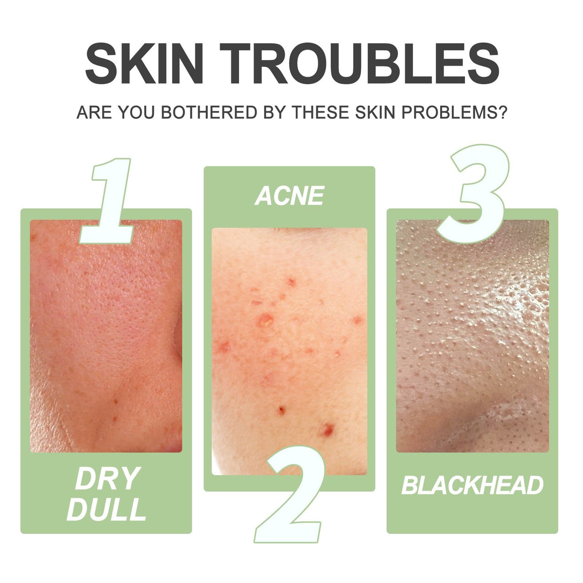 Brightening Cleansing Exfoliating Gel for Smoother, Clear, Radiant Skin ,30ml
