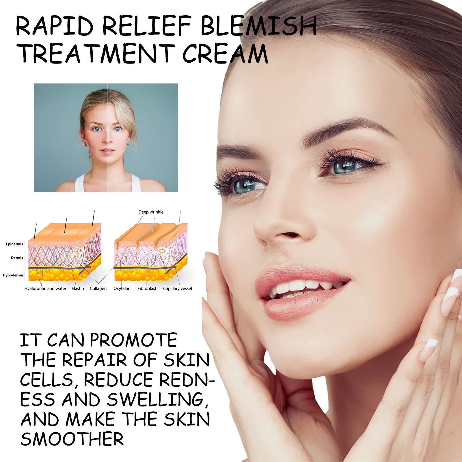 Rapid Relief Face Cream for Dark Spots, Brightening, Moisturizing, Acne Treatment ,20g