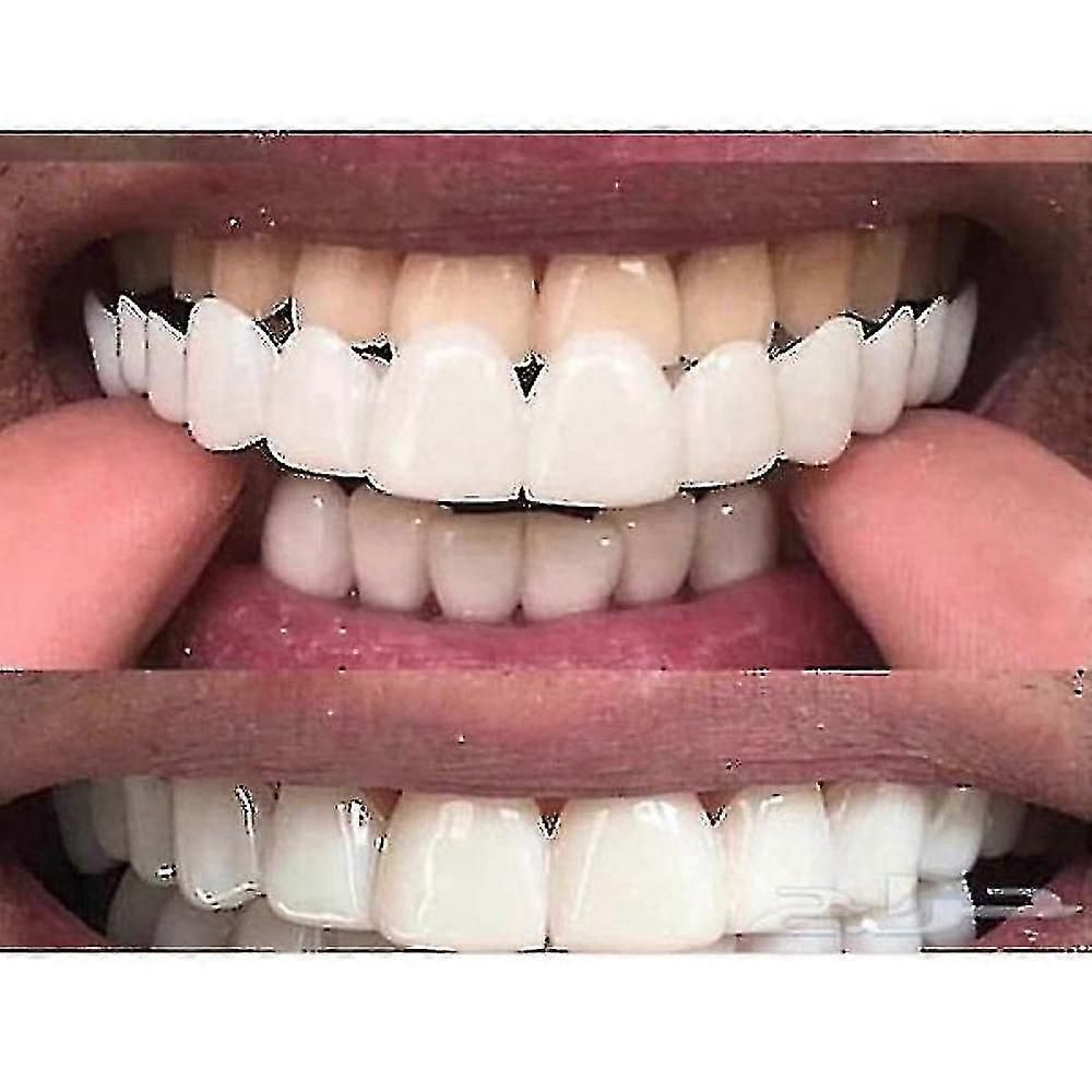 Upper/lower Comfort Fit Flex Whitening Denture Braces zxin