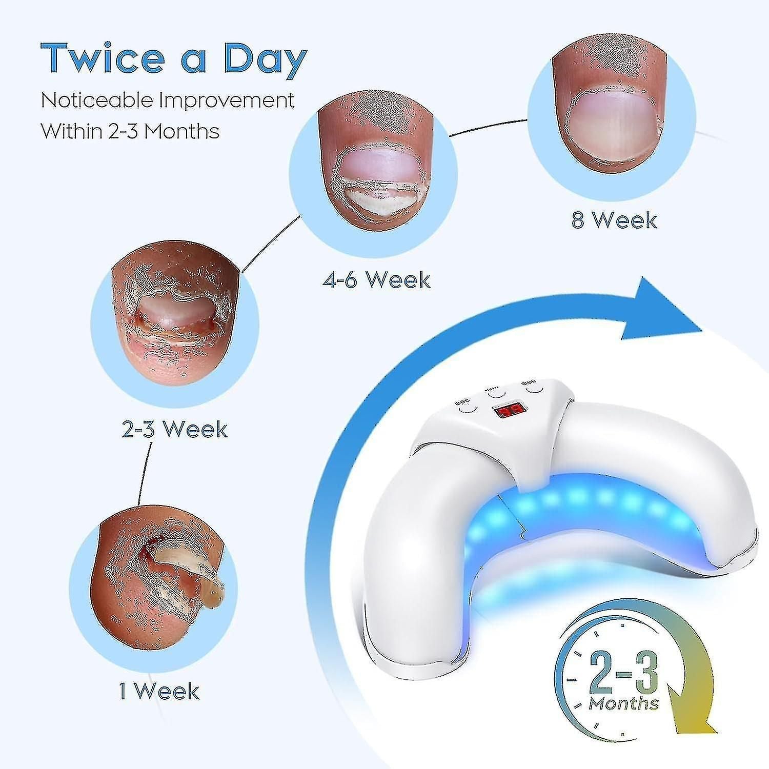 2024 Nail Fungus Laser Treatment Device For Multiple Toenail, Home Use 905nm Infrared Light + 470nm Blue Light Toe Nail Fungus Deviceaa