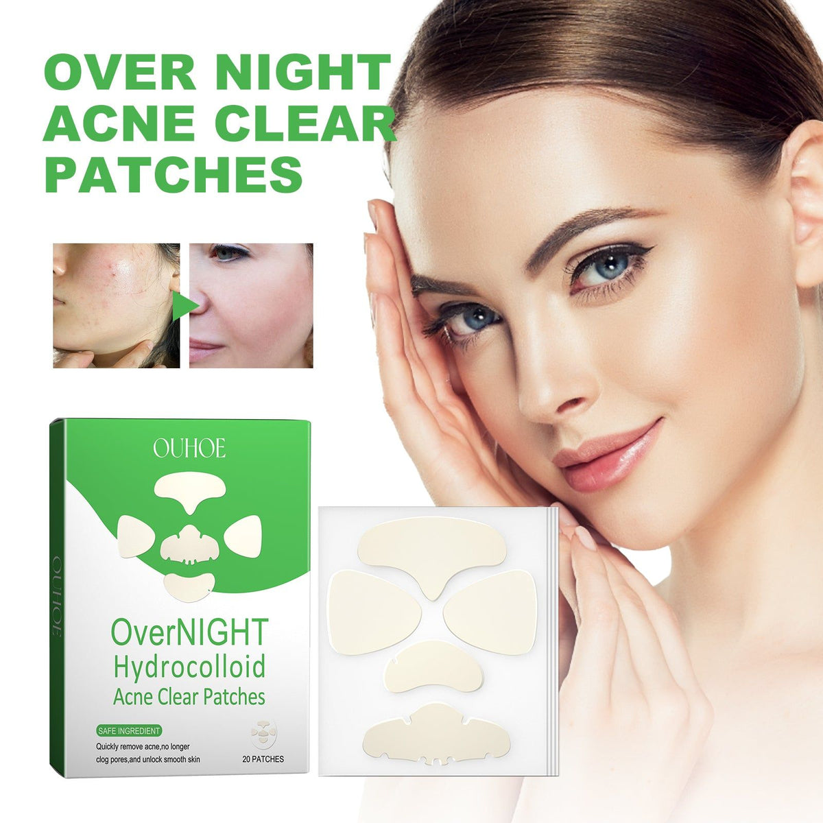 Overnight Acne Repair Patches, Clear Pimples Fast, Reduce Scars, Gentle Skin Care ,20patches