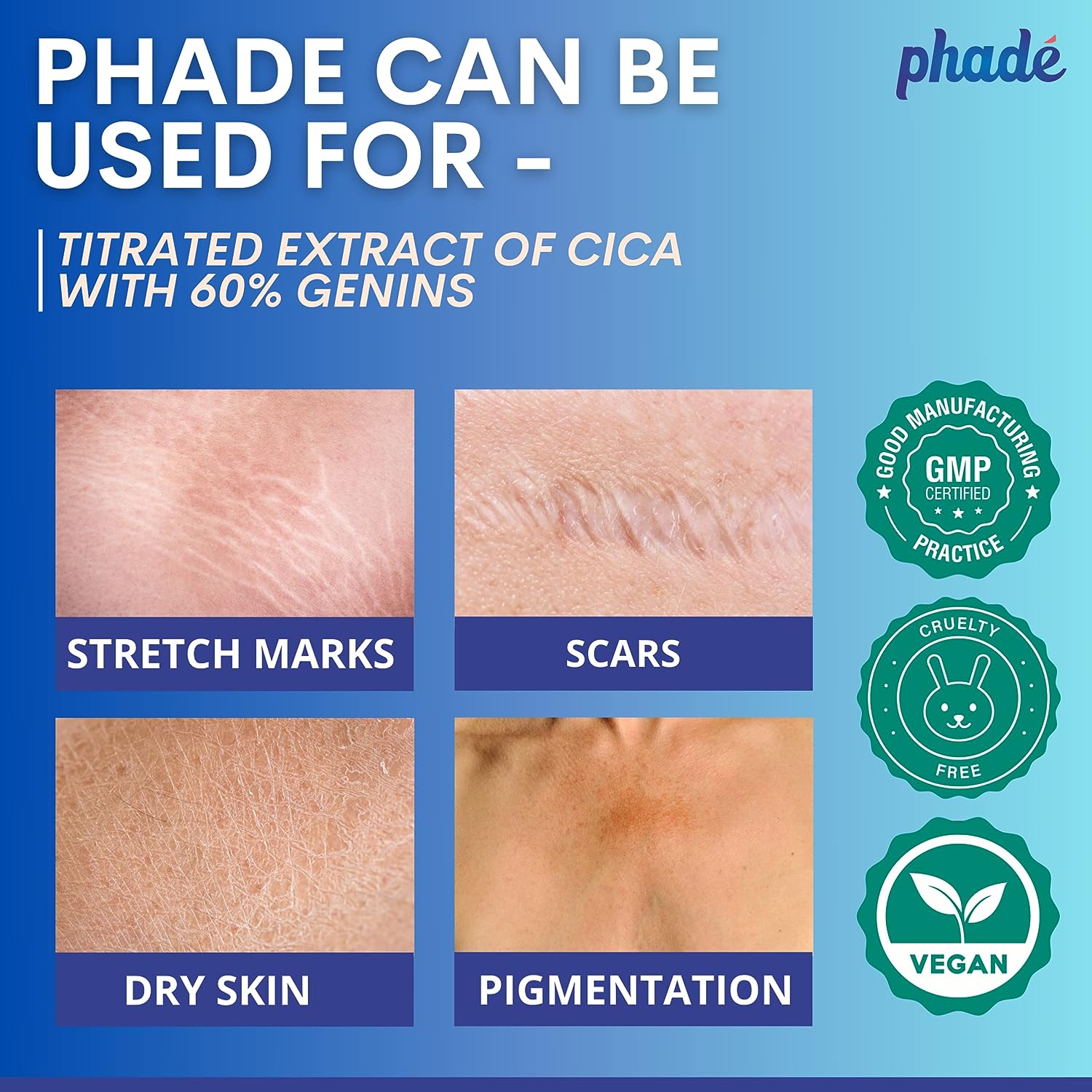 Phade Stretch mark cream 200 ml