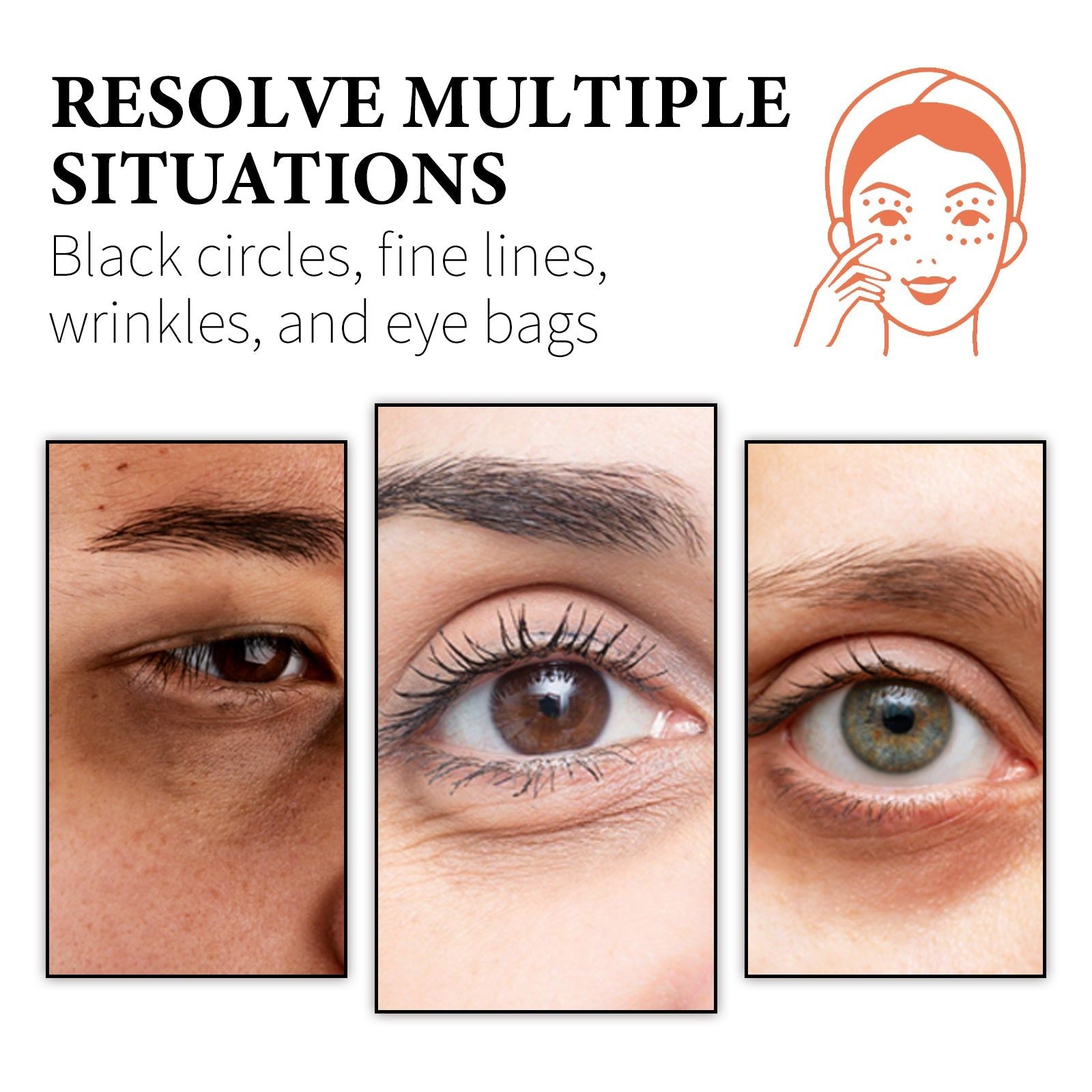Revitalizing Periocular Care, Retinol Collagen Eye Cream for Dark Circles, Wrinkles, and Firming ,30g