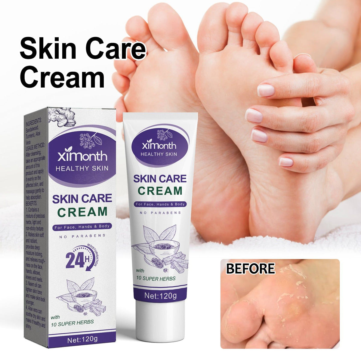 Anti-Crack Skin Care Cream, Deep Moisturizer for Soft, Smooth, Radiant Skin ,120g