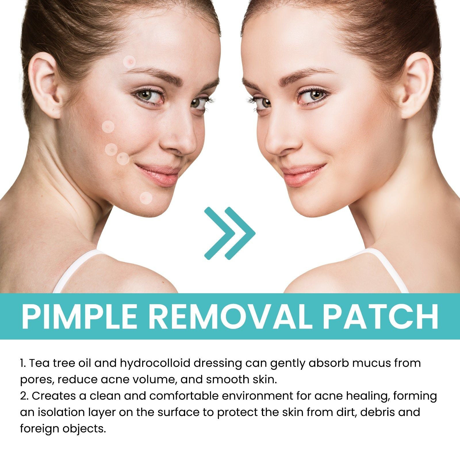 Reduce Acne Fast, Invisible Breathable Patches, Clear Skin, 240pcs ,240pcs