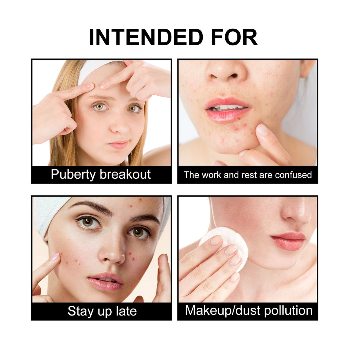 Reduce Acne Fast, Cute Black Pimple Patch, Clear Skin, Spot Treatment ,108pcs
