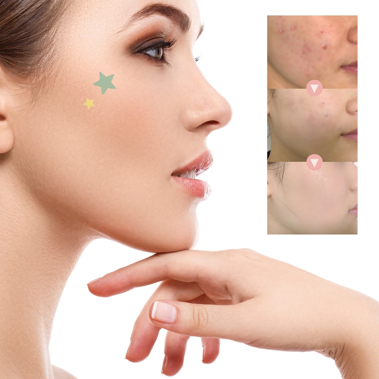 Reduce Acne Fast, Waterproof Breathable Pimple Patches, Clear Skin Solution ,216 patches