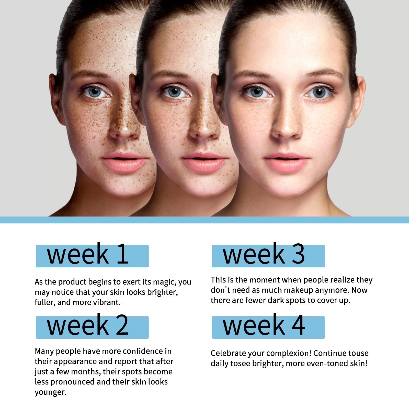 Brightening Dark Spot Corrector, Even Skin Tone, Melasma Repair, Acne Scar Fade ,55ml