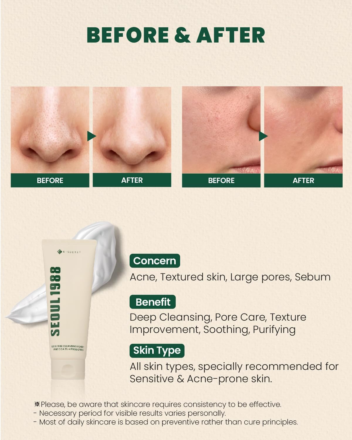 K-SECRET SEOUL 1988 Cleansing Foam : Pine Cica 1% + Probiotics