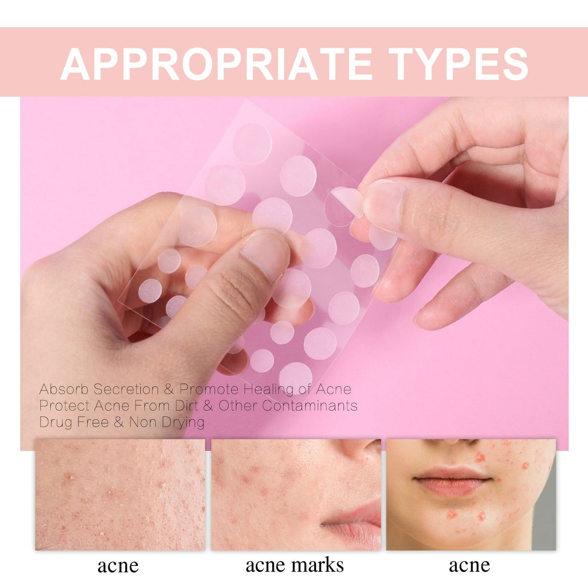 Acne Patch, Purify Pores, Clear Pimples, Invisible Breathable Acne Spot Treatment ,720pcs