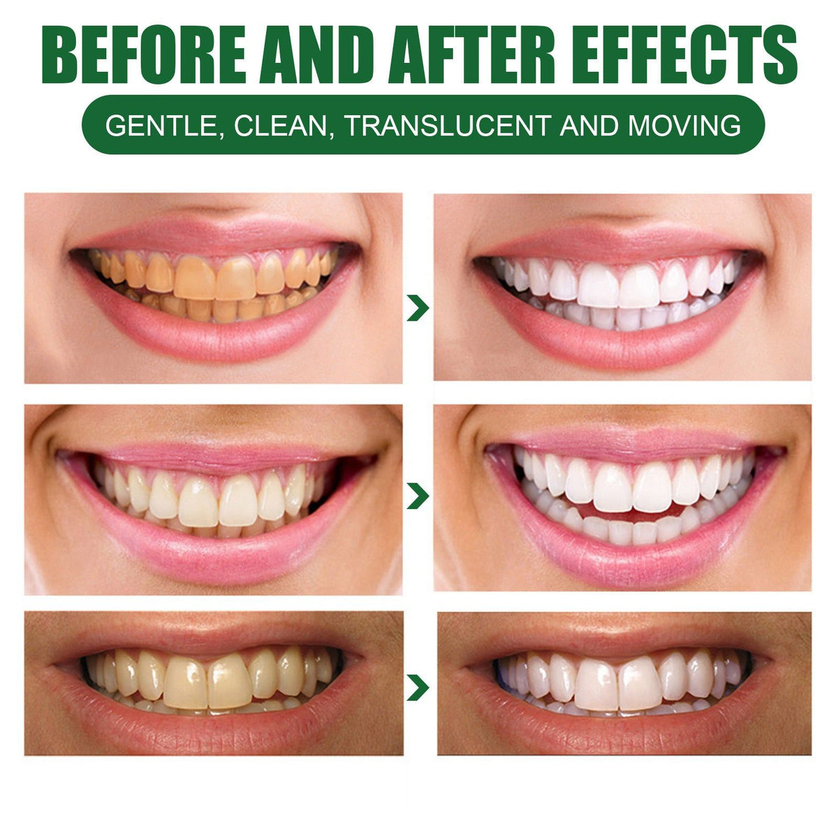 3-Day Whitening Tooth Mousse, Fresh Breath, Remove Stains, Brighten Smile ,60ml