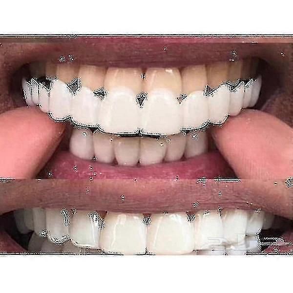 Upper/lower Comfort Fit Flex Whitening Denture Braces zxin
