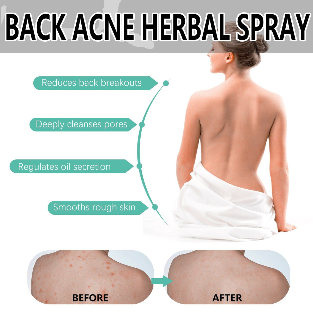 Oce Aura Back Acne Herbal Spray, Repair Acne Marks, Clear Skin, Natural Acne Solution ,120ml