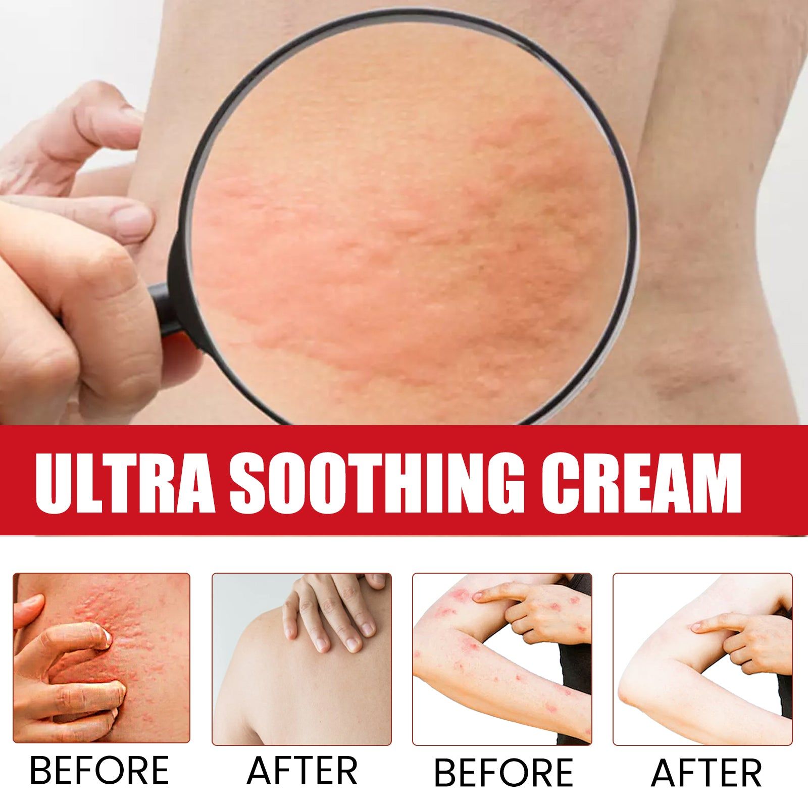 Ultra Soothing Cream, Relieve Skin Redness and Itchiness, Fast Relief for Mosquito Bites, Rash, and Skin Irritation ,60g
