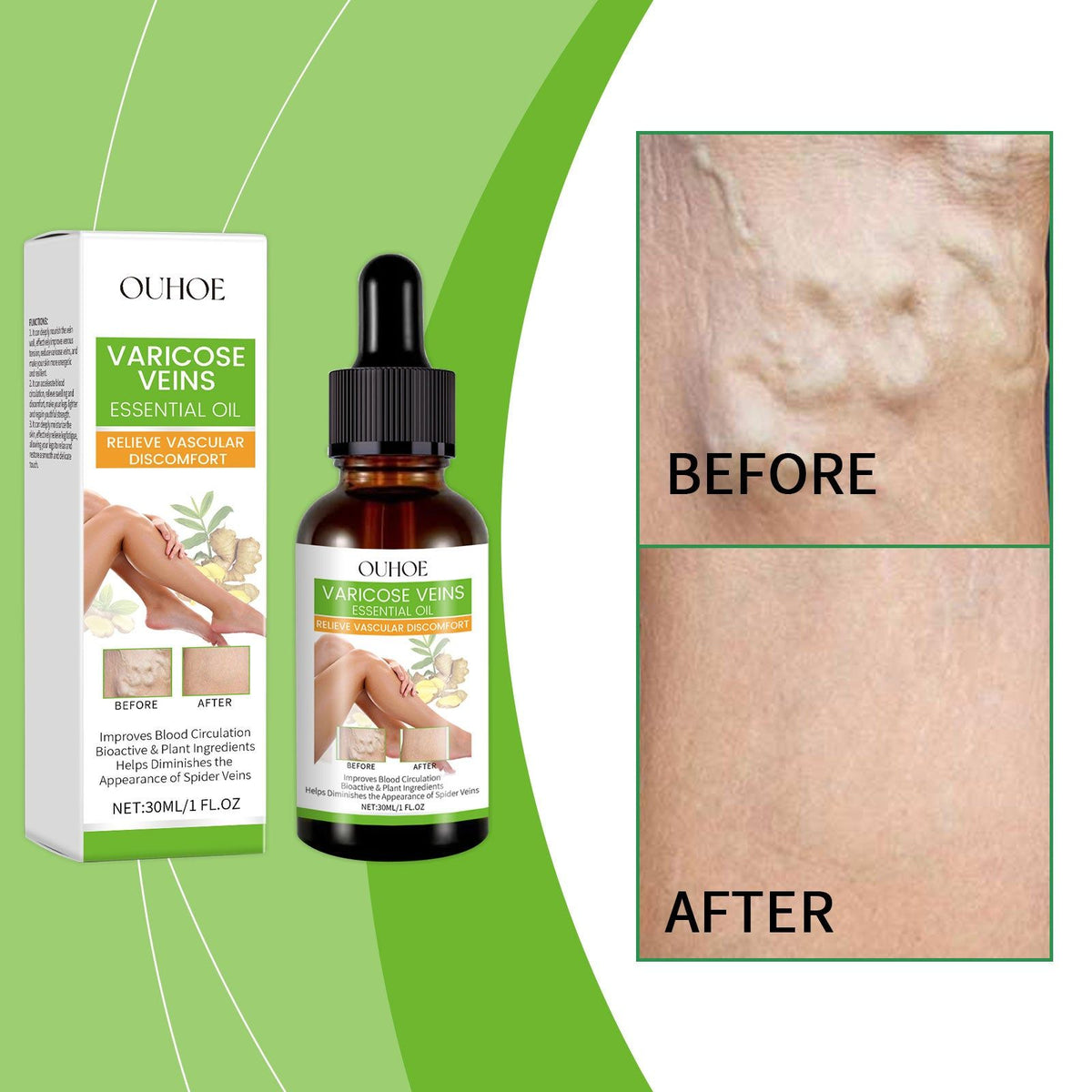 Body Care Leg Treatment with Essential Oils, Moisturizing, Soothes Varicose Veins ,30ml