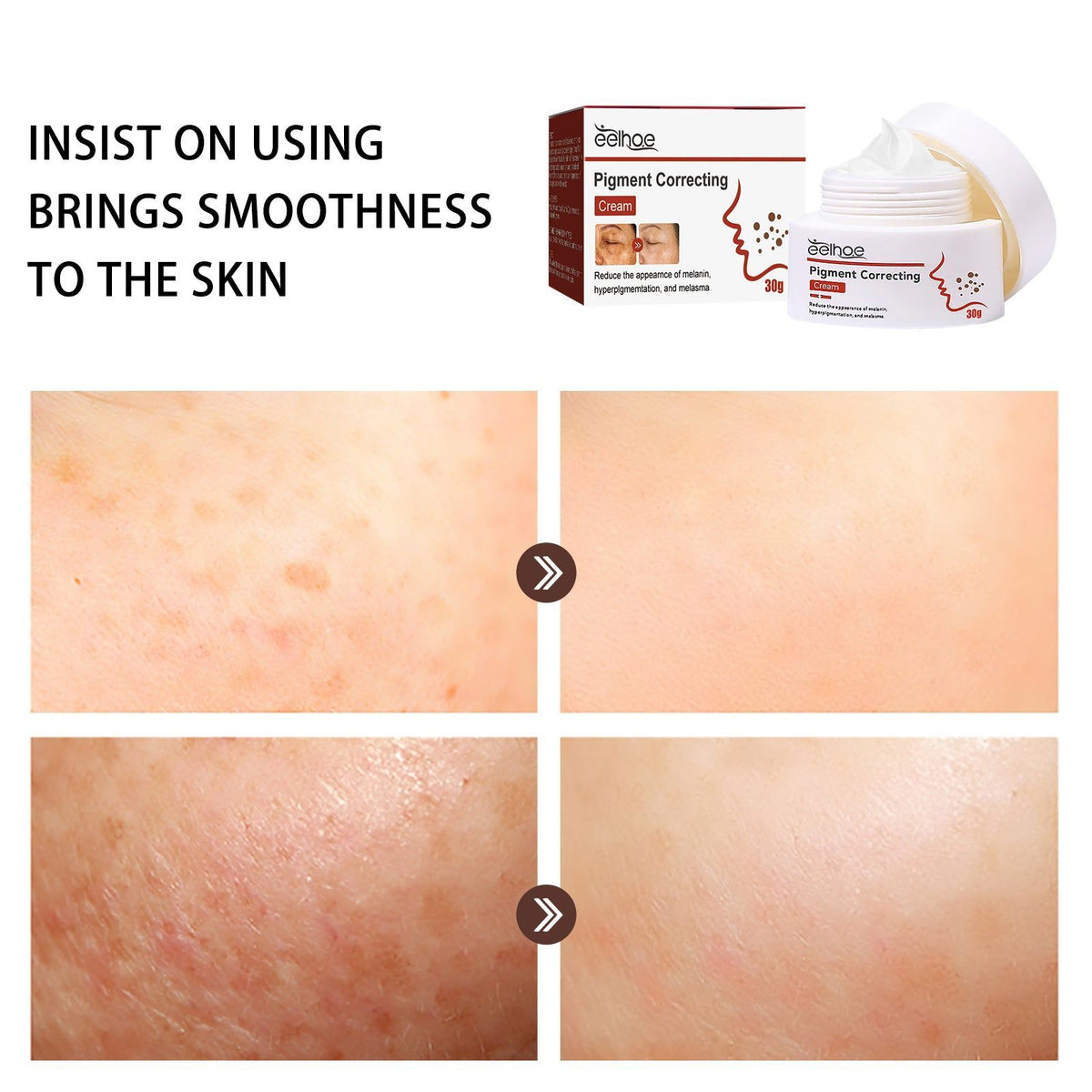 Brighten Skin Fade Dark Spots Melasma Cream, Hydrating, Gentle, Daily Care ,30g