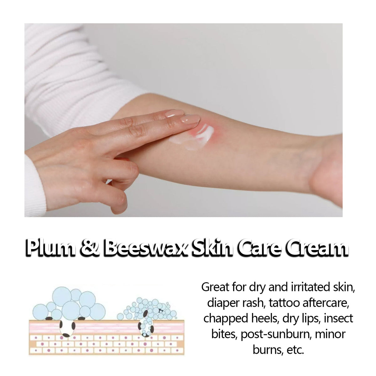 Ultimate Beeswax Skin Care Cream, Moisturizes, Relieves Dry, Sunburn, Insect Bites ,50g