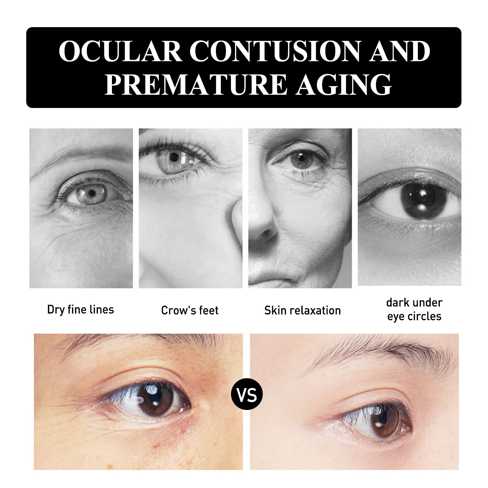 Ultimate Eye Lift and Moisturize Cream, Reduce Wrinkles, Dark Circles, Puffiness ,30ml
