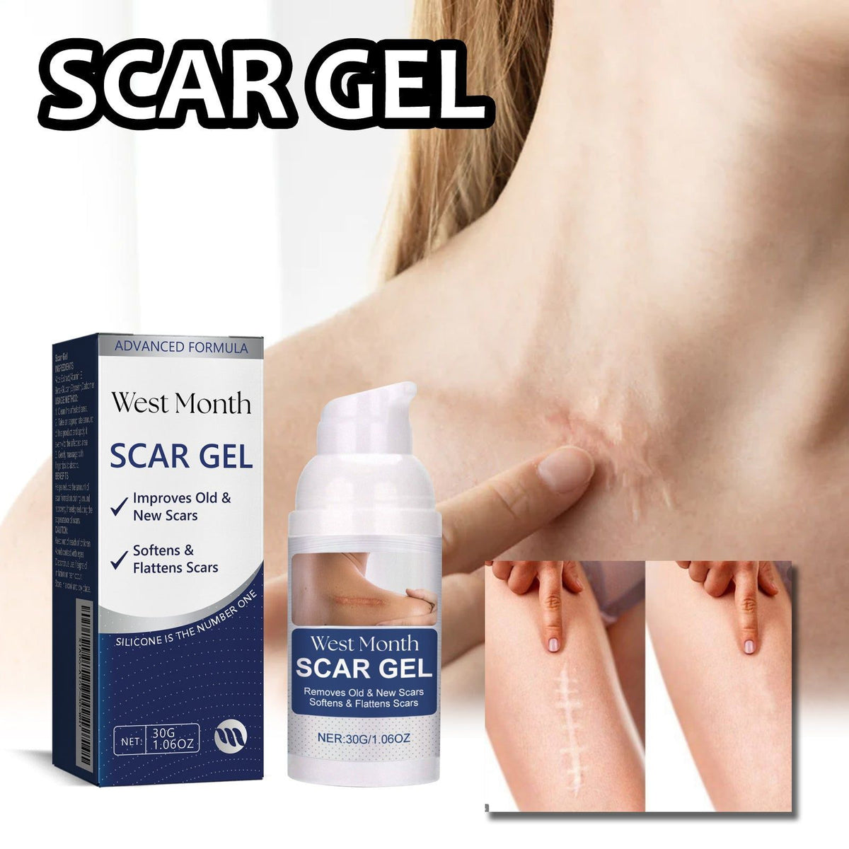 Fade Scar Gel for Clear Skin, Repair Damaged Skin, Natural Scar Removal, Moisturizing ,30g
