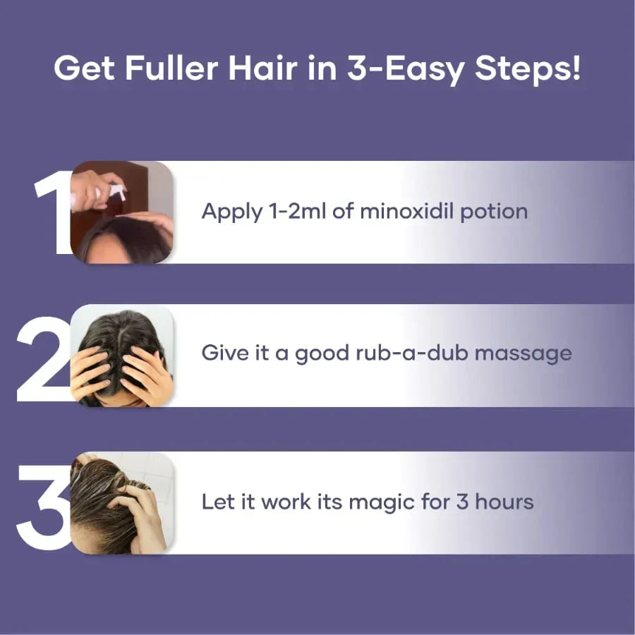 GHC Saturn minoxidil topical solution 60 ml/2.0 FL OZ