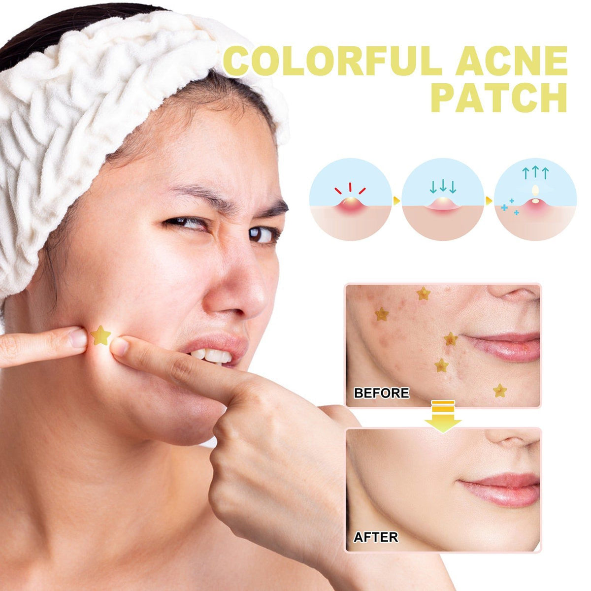 Yellow Acne Patch, Repair Pimples, Clear Skin, Fast Healing, Moisturizing ,140patches