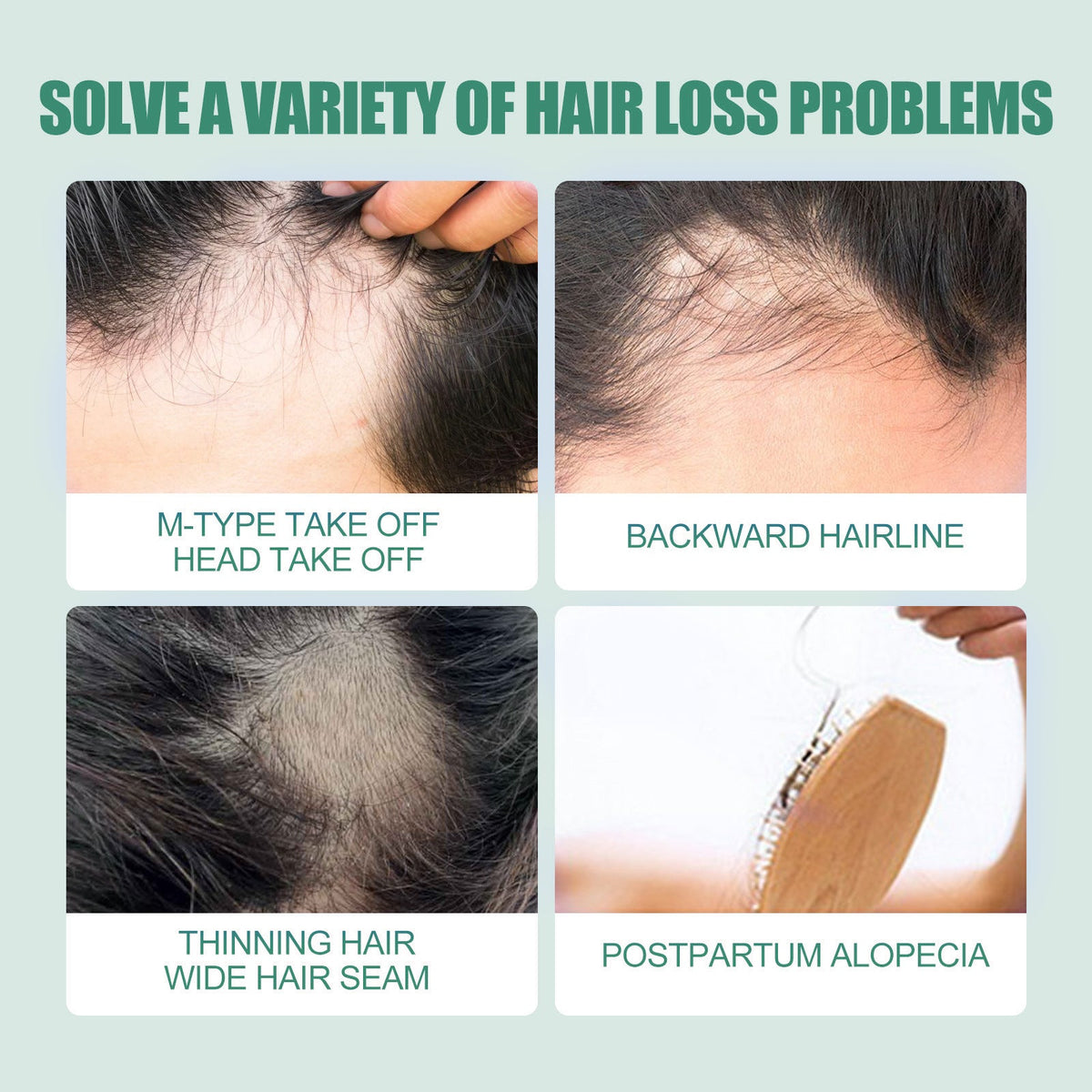 7-Day Hair Essence, Accelerate Hair Growth, Nourish Scalp, Hair Regrowth Treatment ,30ml