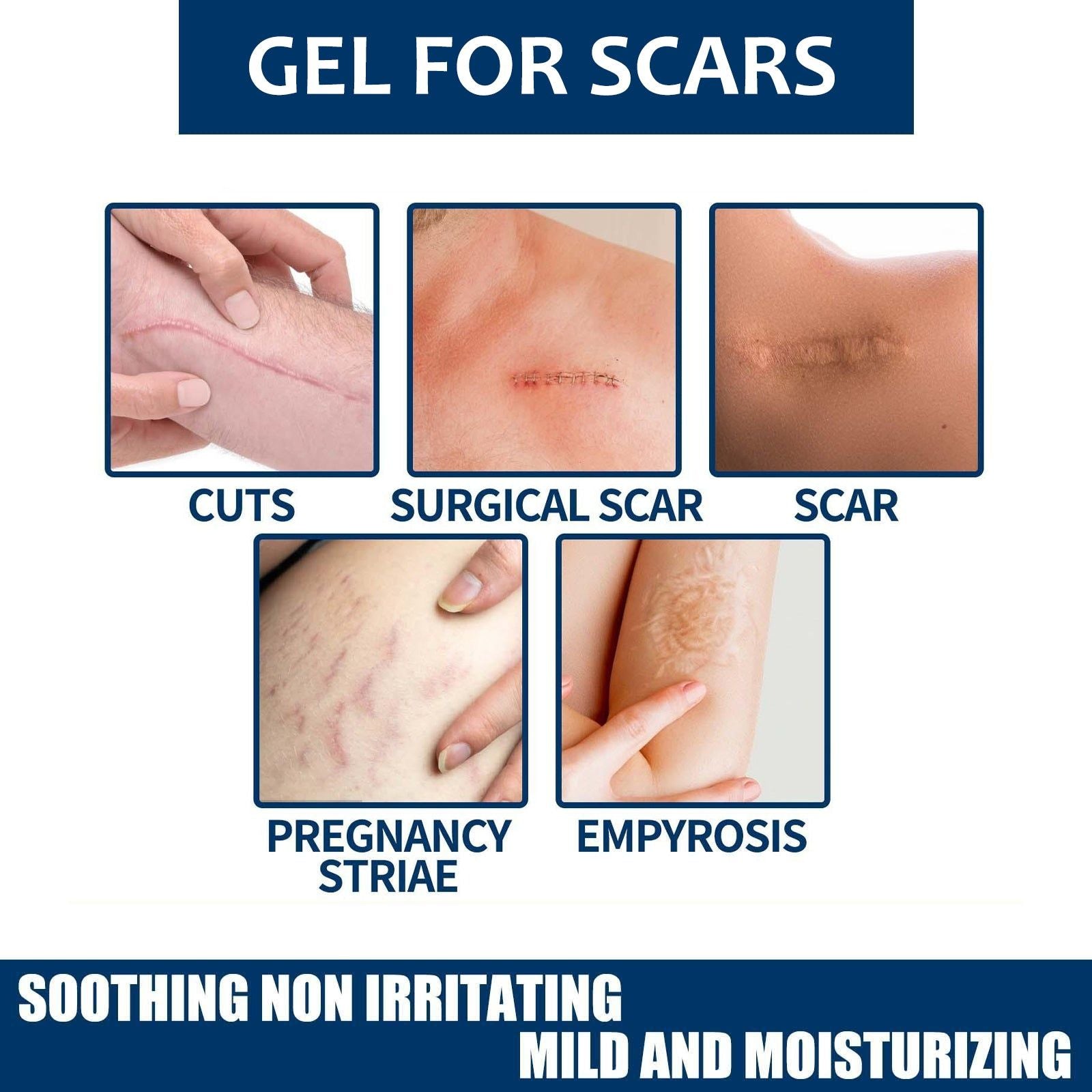 Fade Scar Gel for Clear Skin, Repair Damaged Skin, Natural Scar Removal, Moisturizing ,30g