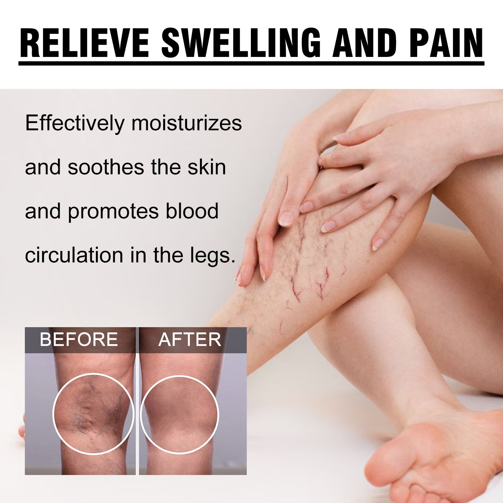 Veins Cream for Body Care, Relieve Varicose Veins, Pain & Swelling ,20g