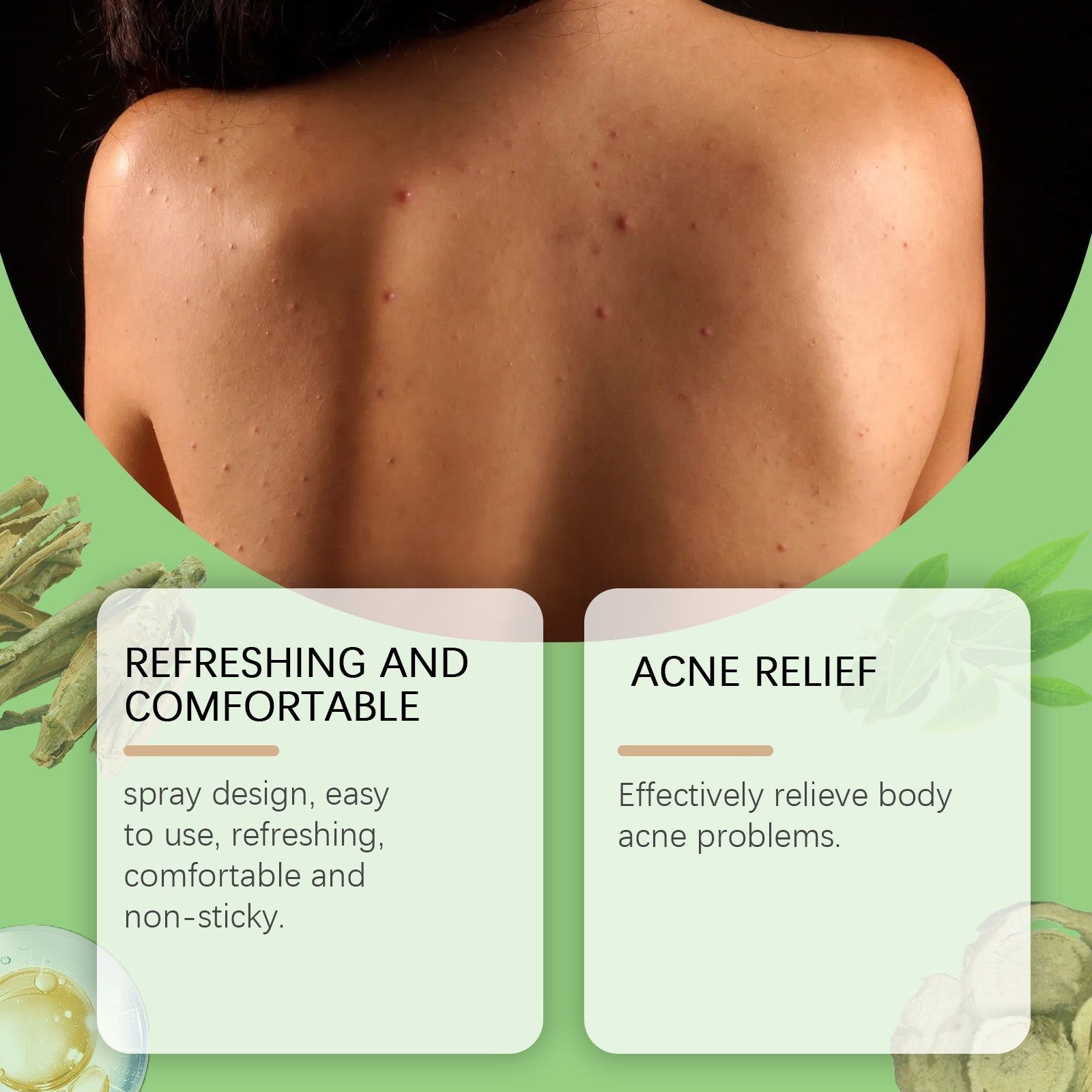 Salicylic Acid Body Herbal Spray, Acne & Skin Hydrating, Refreshing, Soothing, Natural Skincare ,100ml