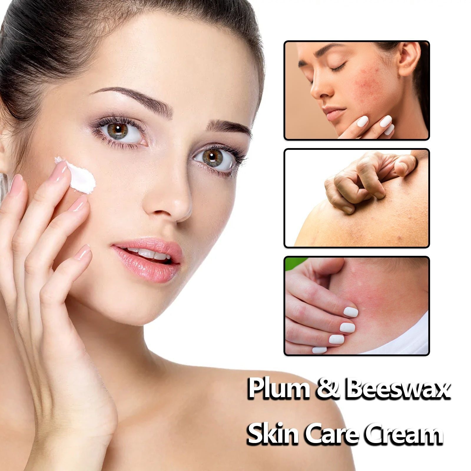 Ultimate Beeswax Skin Care Cream, Moisturizes, Relieves Dry, Sunburn, Insect Bites ,50g