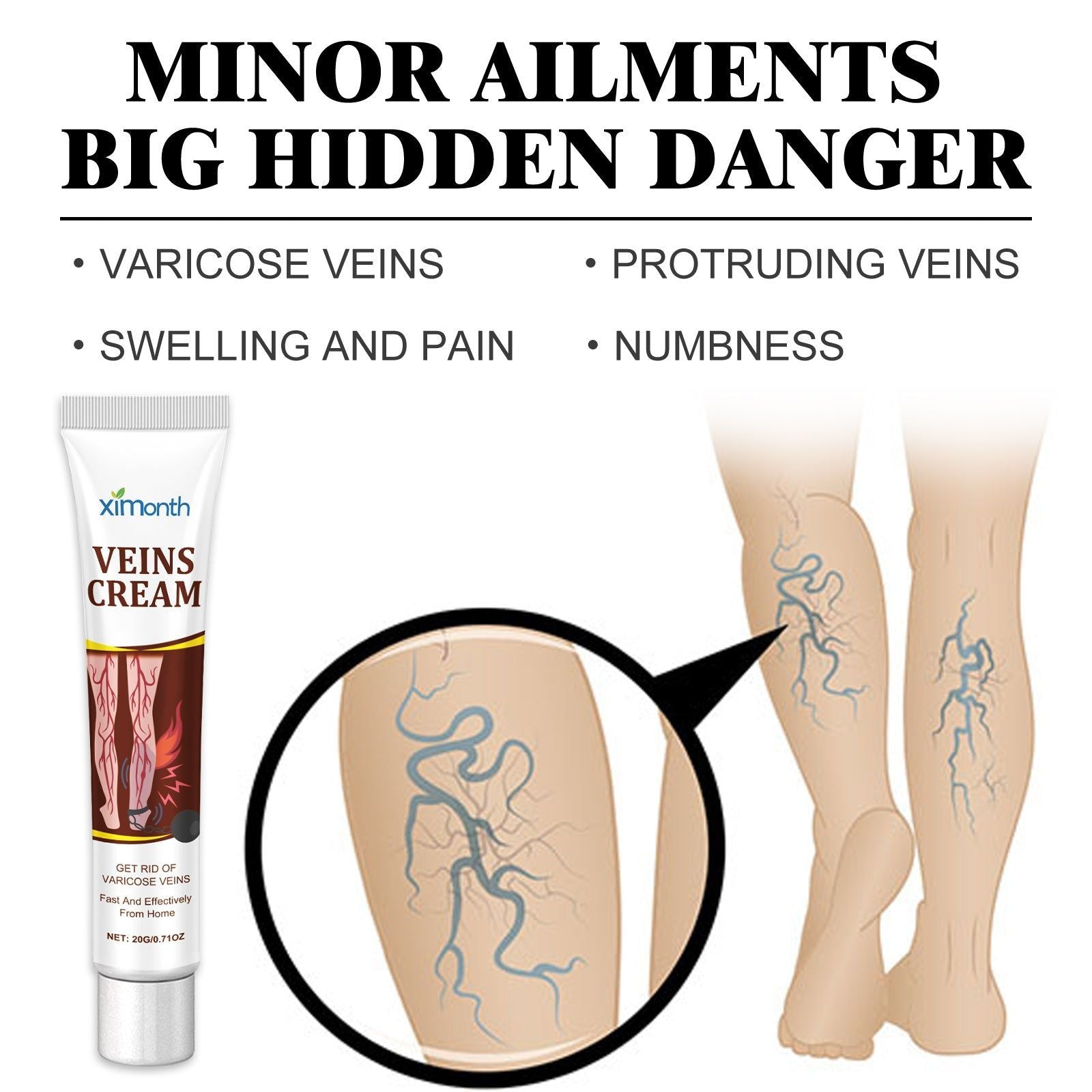 Veins Cream for Body Care, Relieve Varicose Veins, Pain & Swelling ,20g