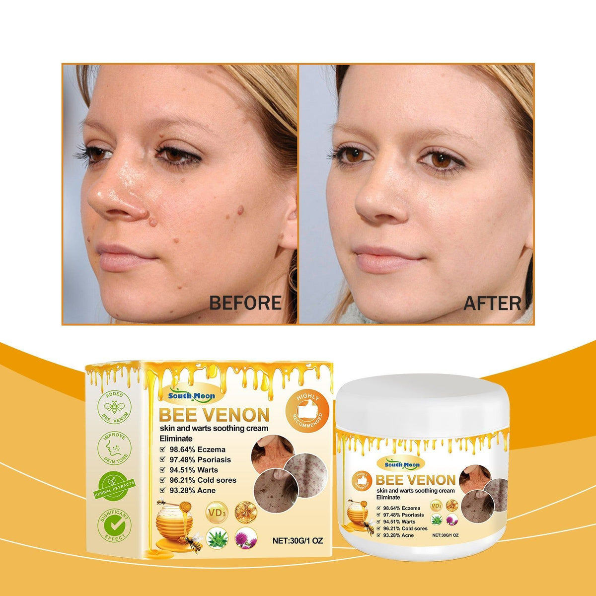 Bee Venom Body Care Cream, Brightening, Moisturizing, Wart & Blemish Treatment ,30g