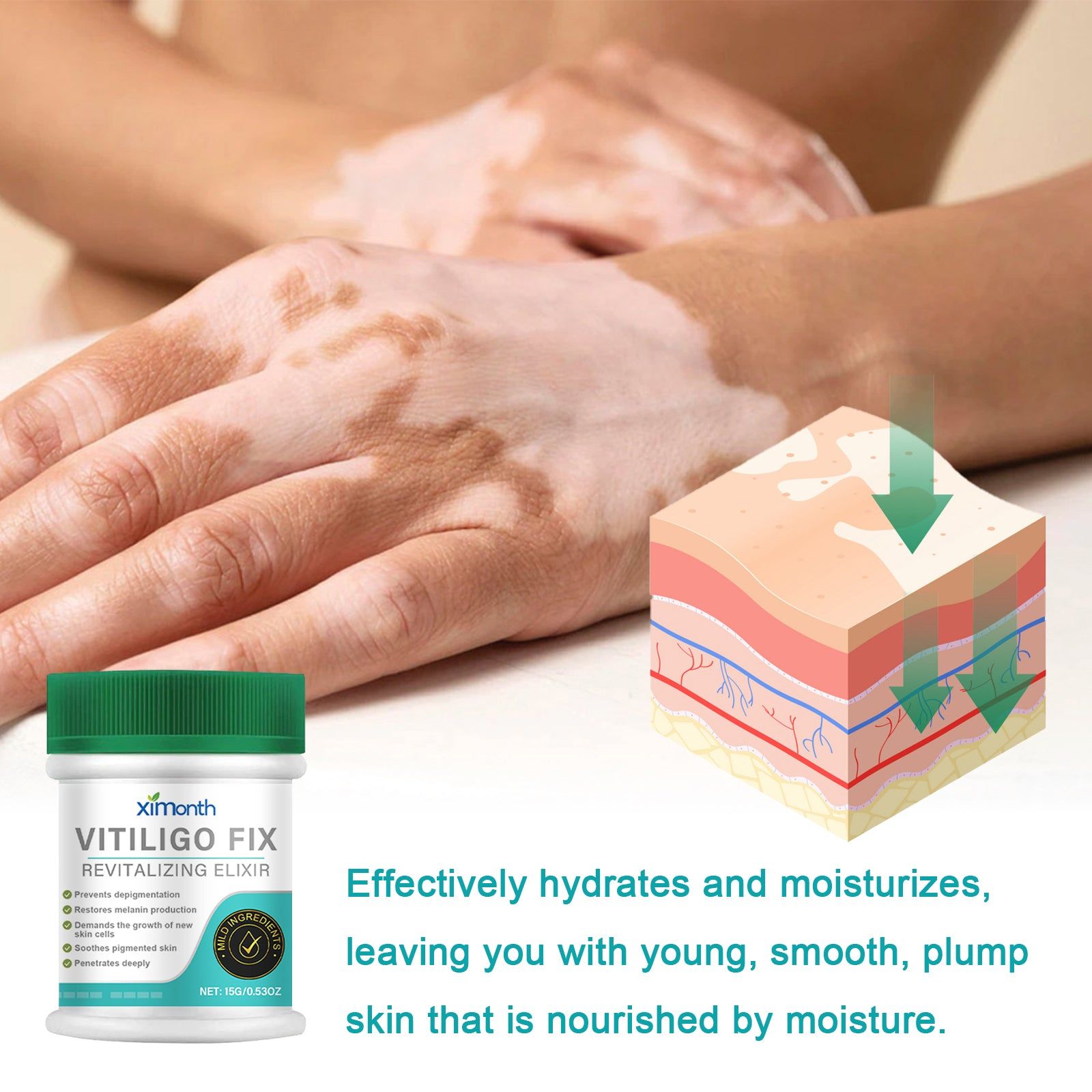 Revitalize Skin Care for Vitiligo, Lighten Spots, Even Tone, Moisturizing Repair ,15g