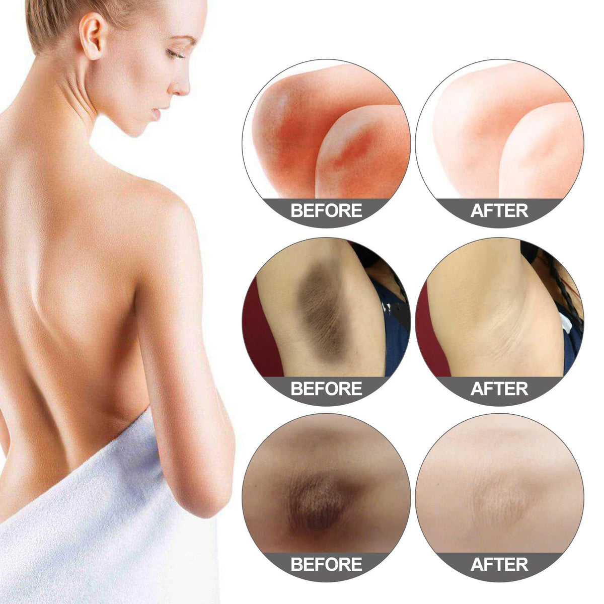 Skin Lightening Cream, Brighten Underarms, Hydrate, Fade Dark Spots, Safe & Gentle ,50g