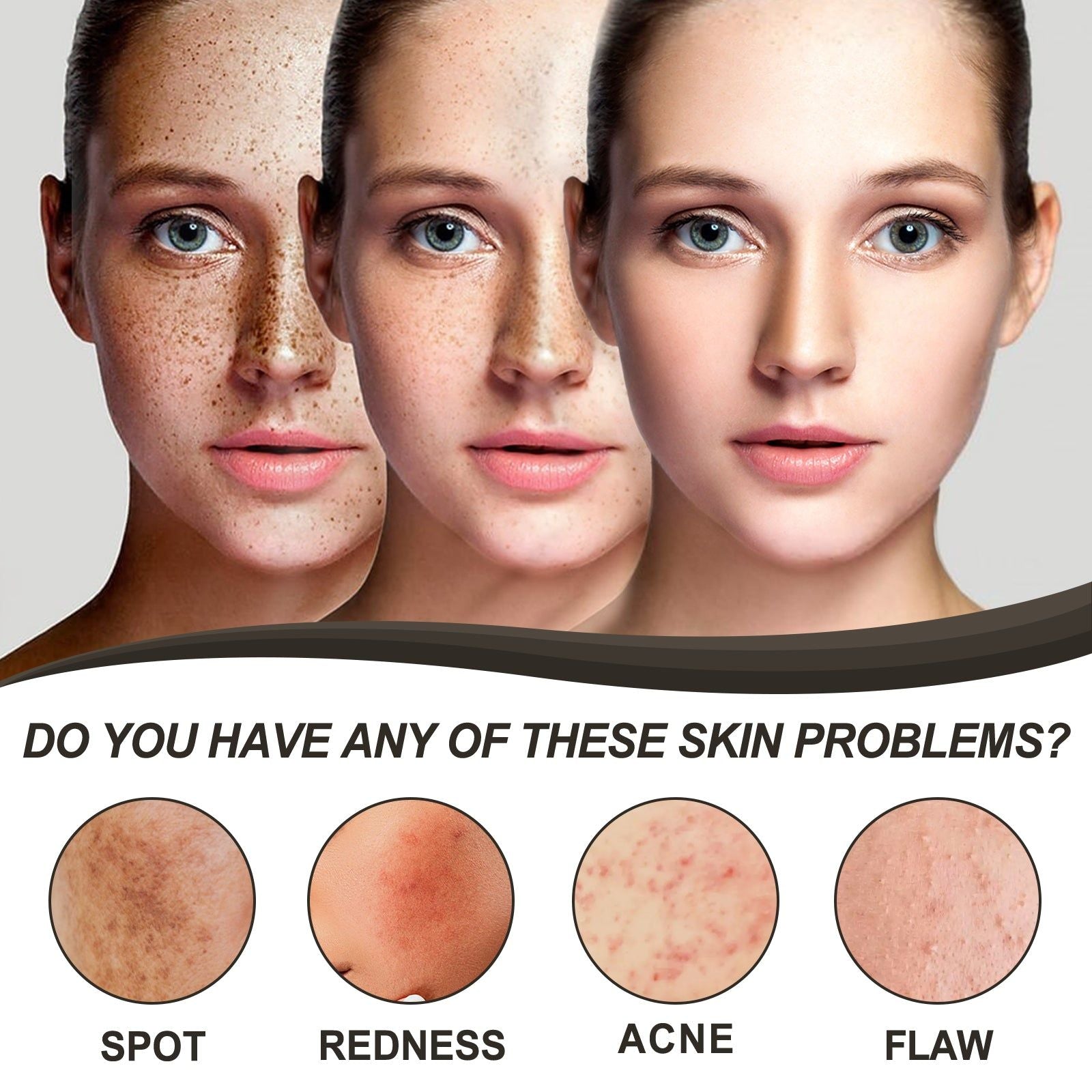 Fade Dark Spots with Micro-needle Vitamin C Patch, Acne & Blemish Repair ,72pcs