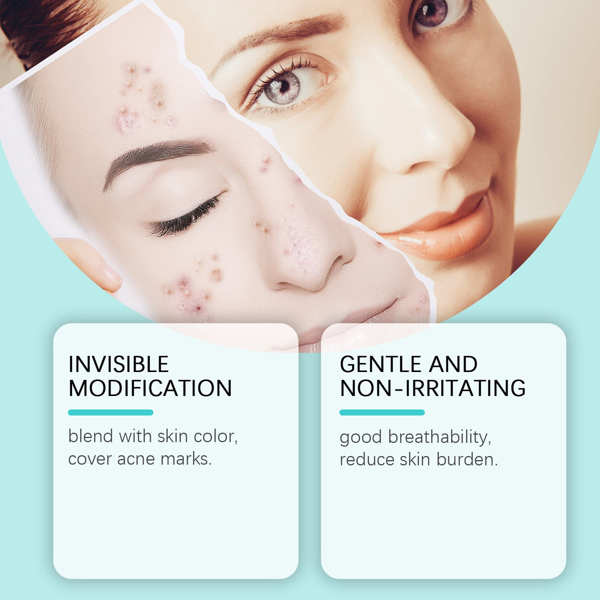 Acne Patch, Clear Skin Fast, Pimple Spot Treatment, Breathable, Portable, Gentle Care ,8 patches