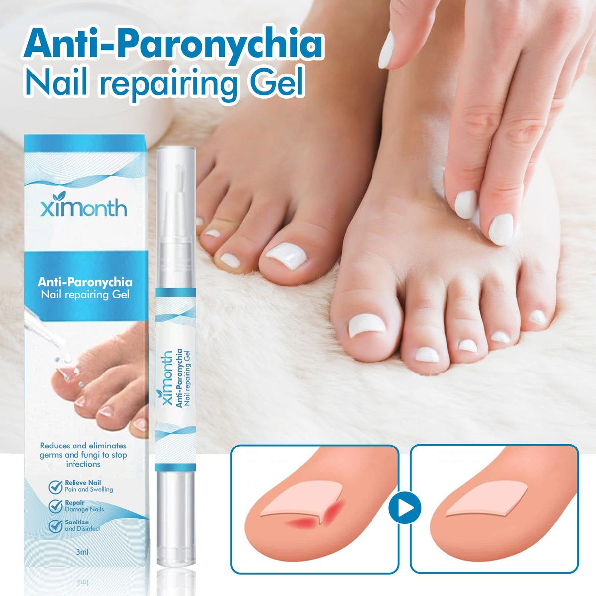 Anti-Paronychia Nail Repair Gel, Fast Pain Relief, Fungal & Bacterial Care, Nail Strengthening, Healthy Nail Care ,3ml