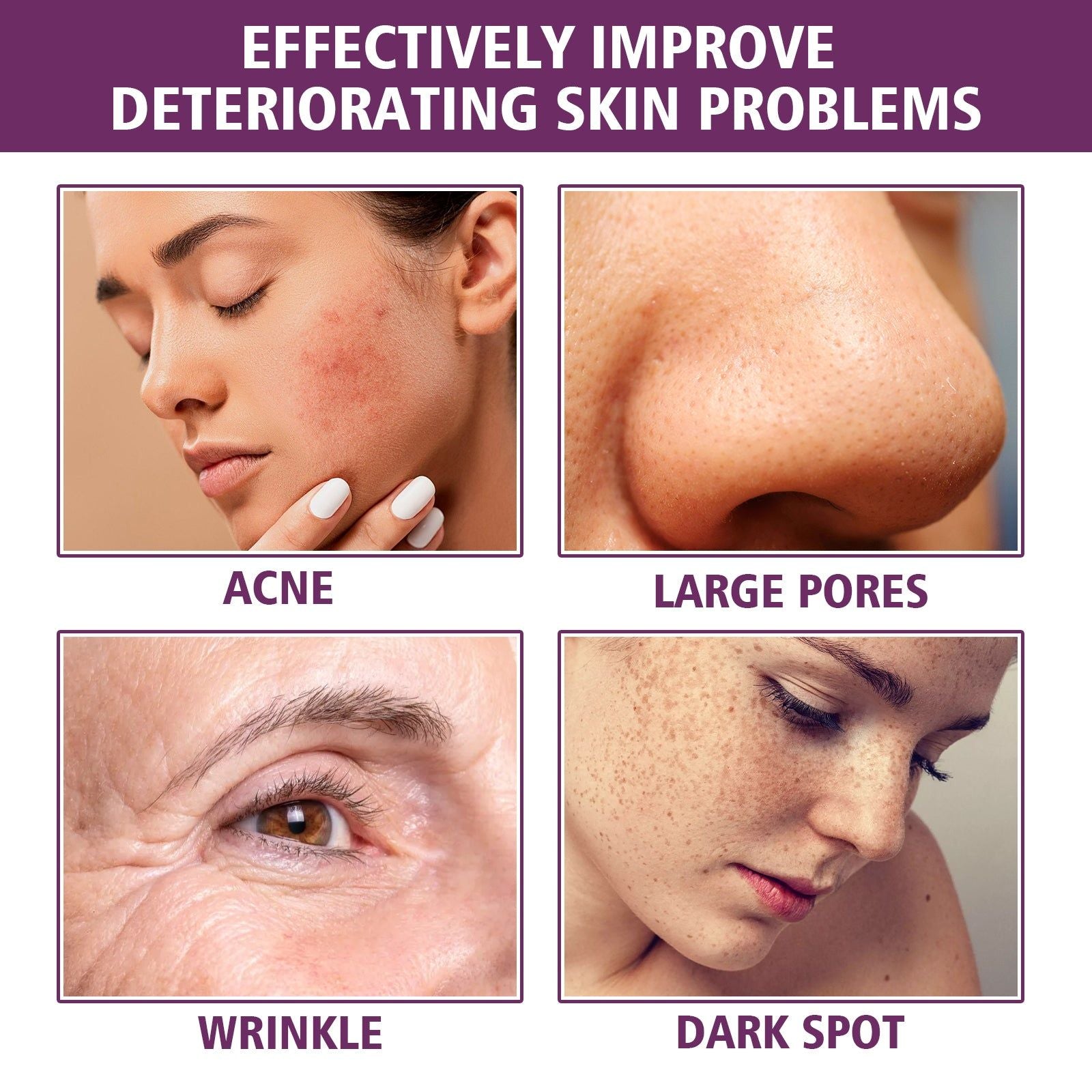 Revitalize Your Skin with Niacinamide Serum, Anti-Wrinkle, Firming, Brightening ,20ml