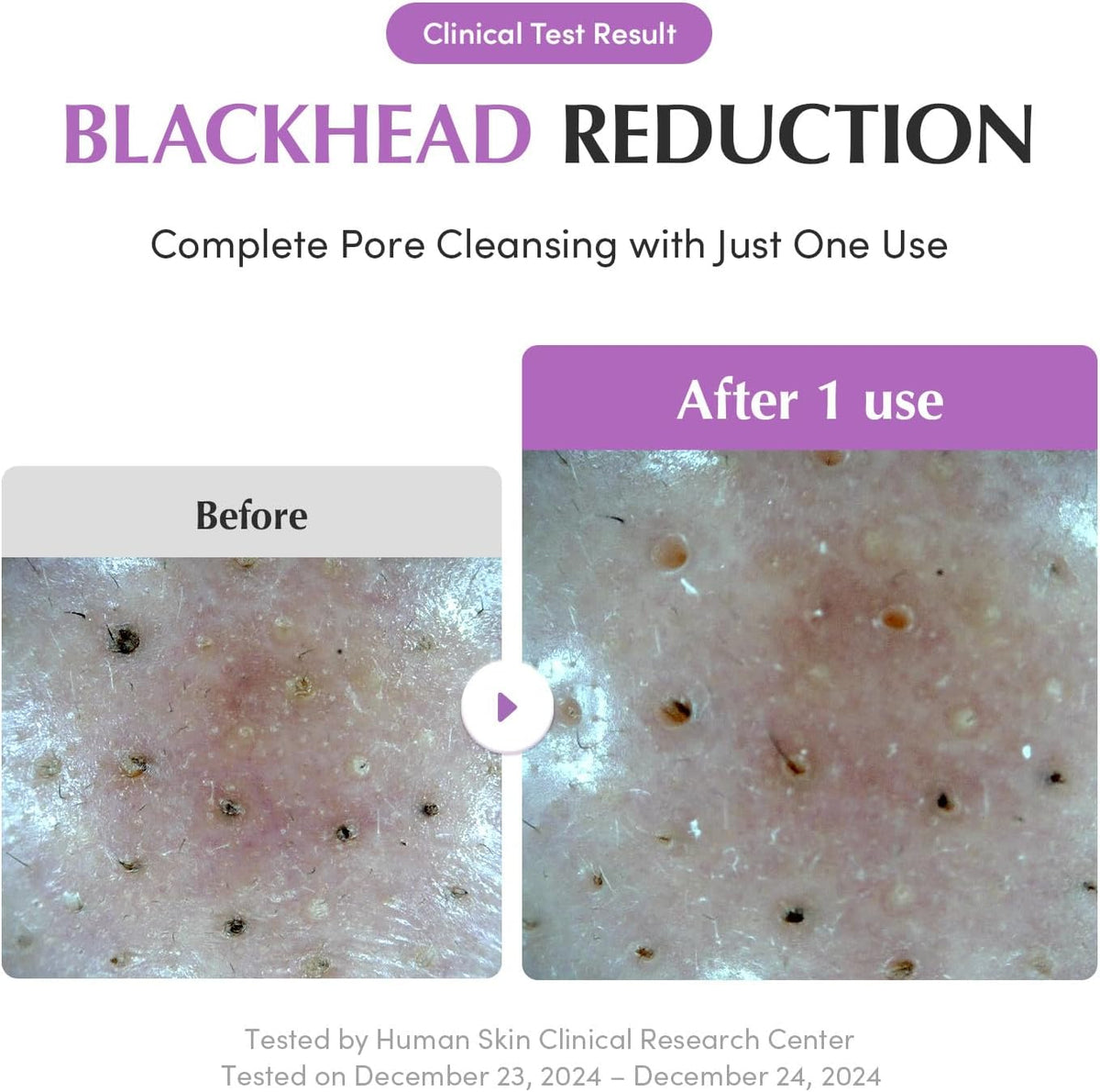 Eqqualberry Purple Rice Pore Purifying Pack Cleanser 130G
