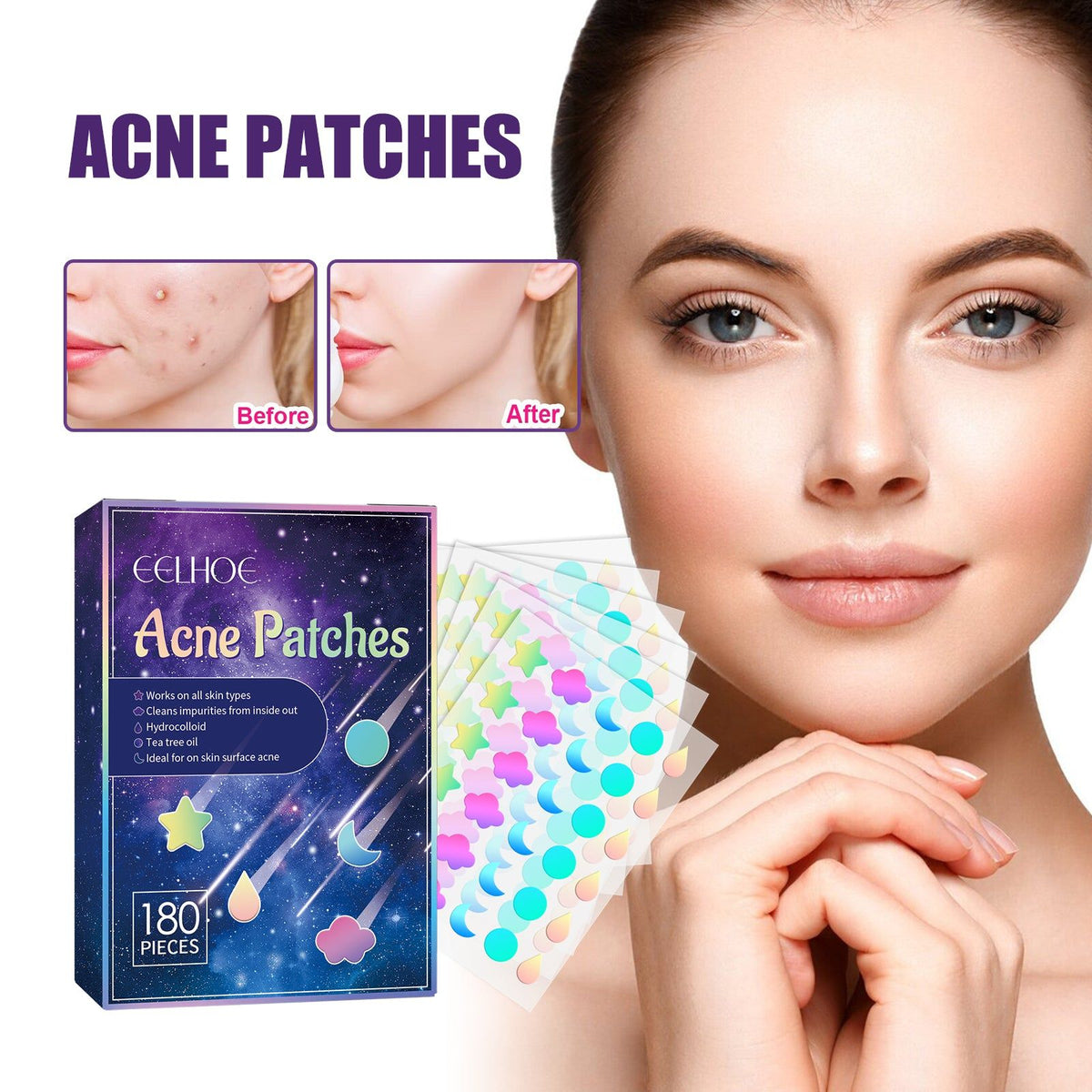 Reduce Acne Fast with Acne Patches, Clear Pores, Heal Skin, Natural Ingredients ,180pcs