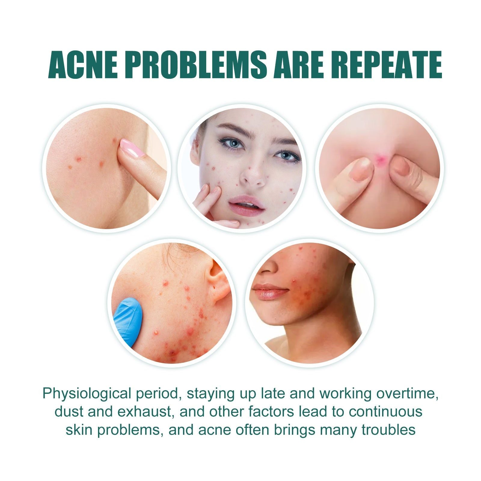 Cover Up Acne Fast, Clear Skin with Star Acne Patches, Gentle & Effective ,112pcs