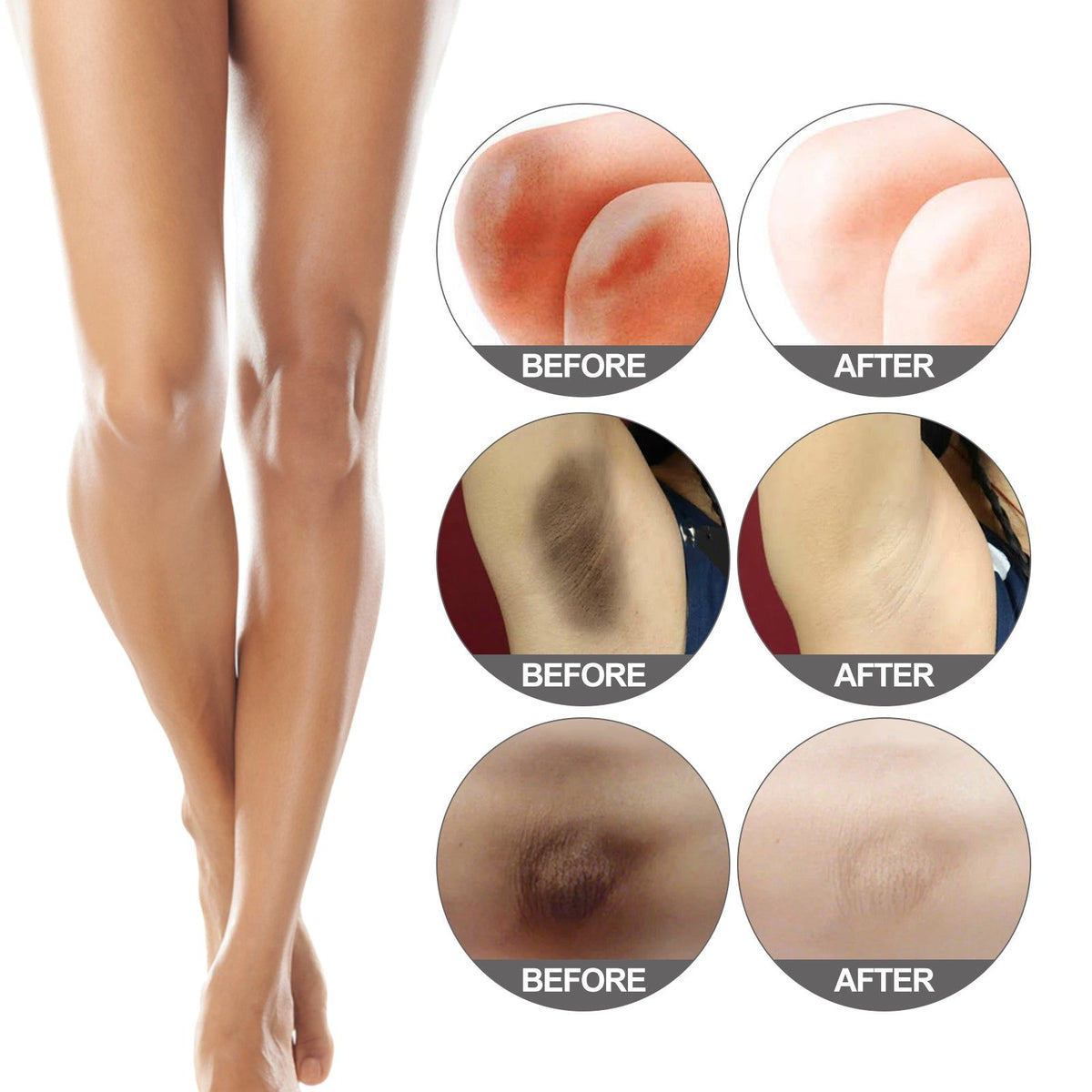 Brightening Body Care Cream for Dull Joints, Dark Spots, Moisturizing, Rejuvenating ,60g