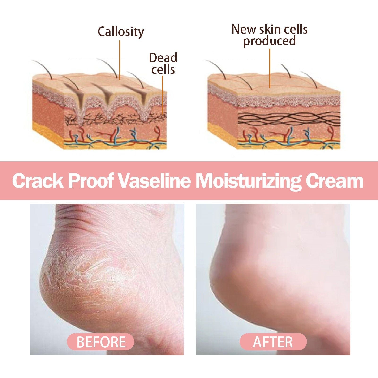 Prevent Dry Hands and Feet from Cracking, Deep Moisturizer with Vitamin E, Shea Butter ,40g