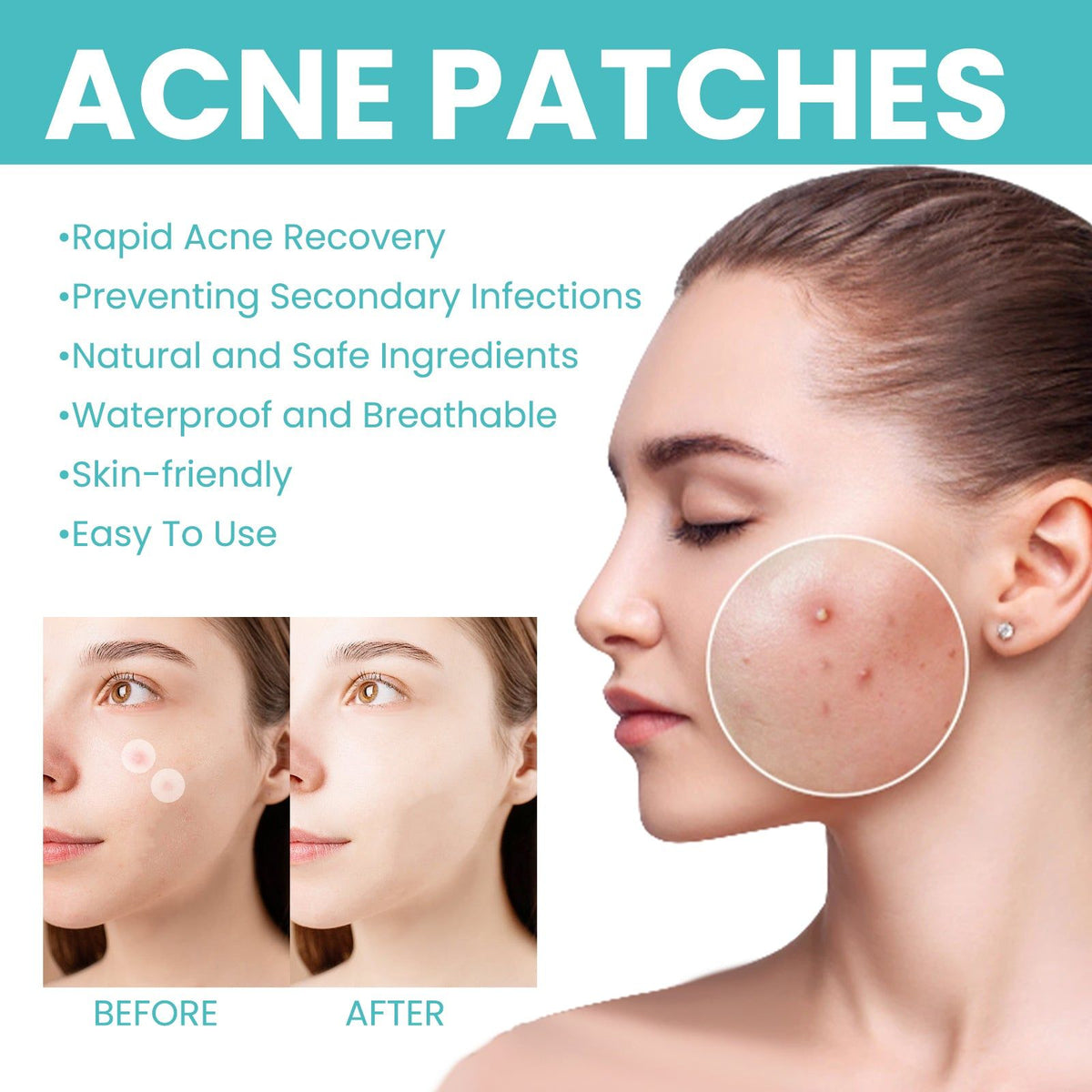 Reduce Acne Fast, Invisible Breathable Patches, Clear Skin, 240pcs ,240pcs