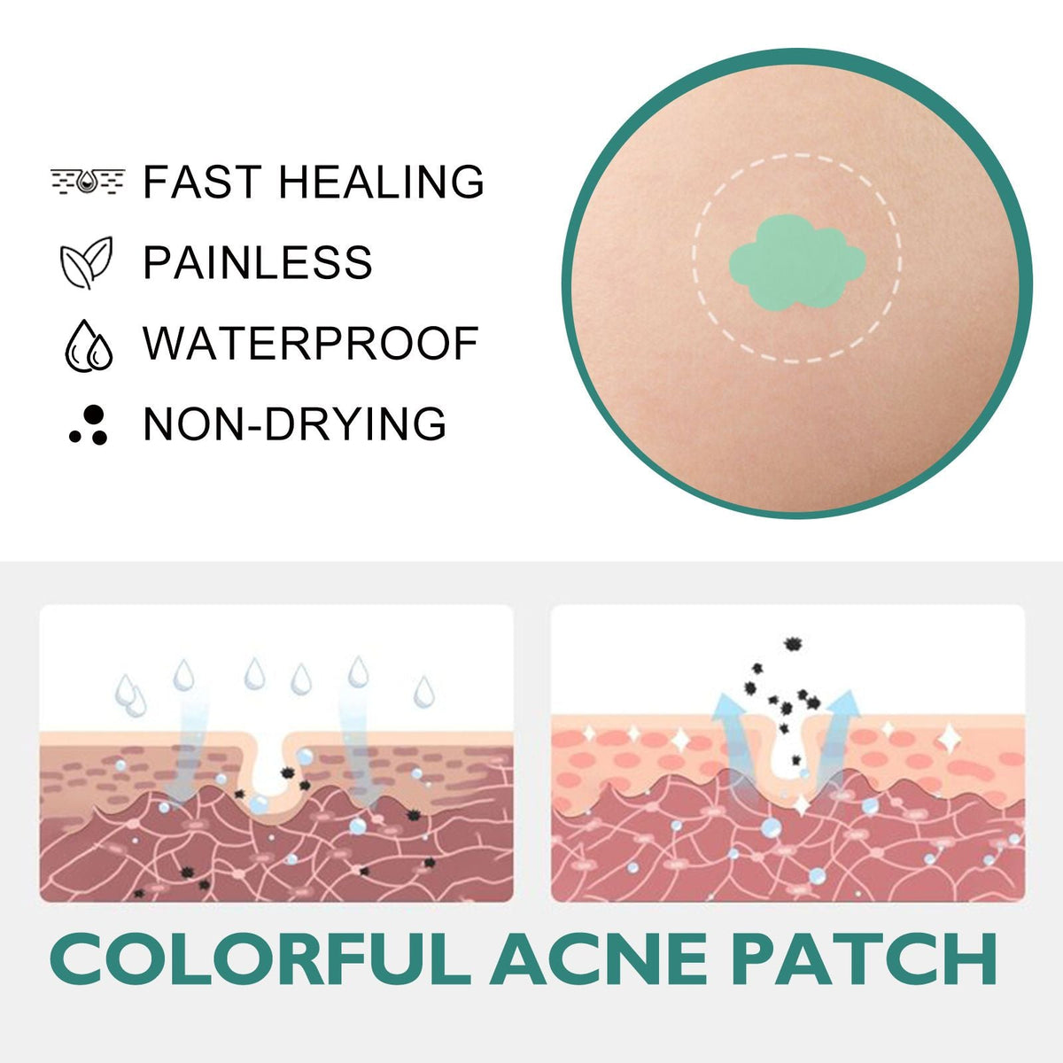 Cartoon Acne Pimple Patches Hydrocolloid Spot Stickers 112pcs